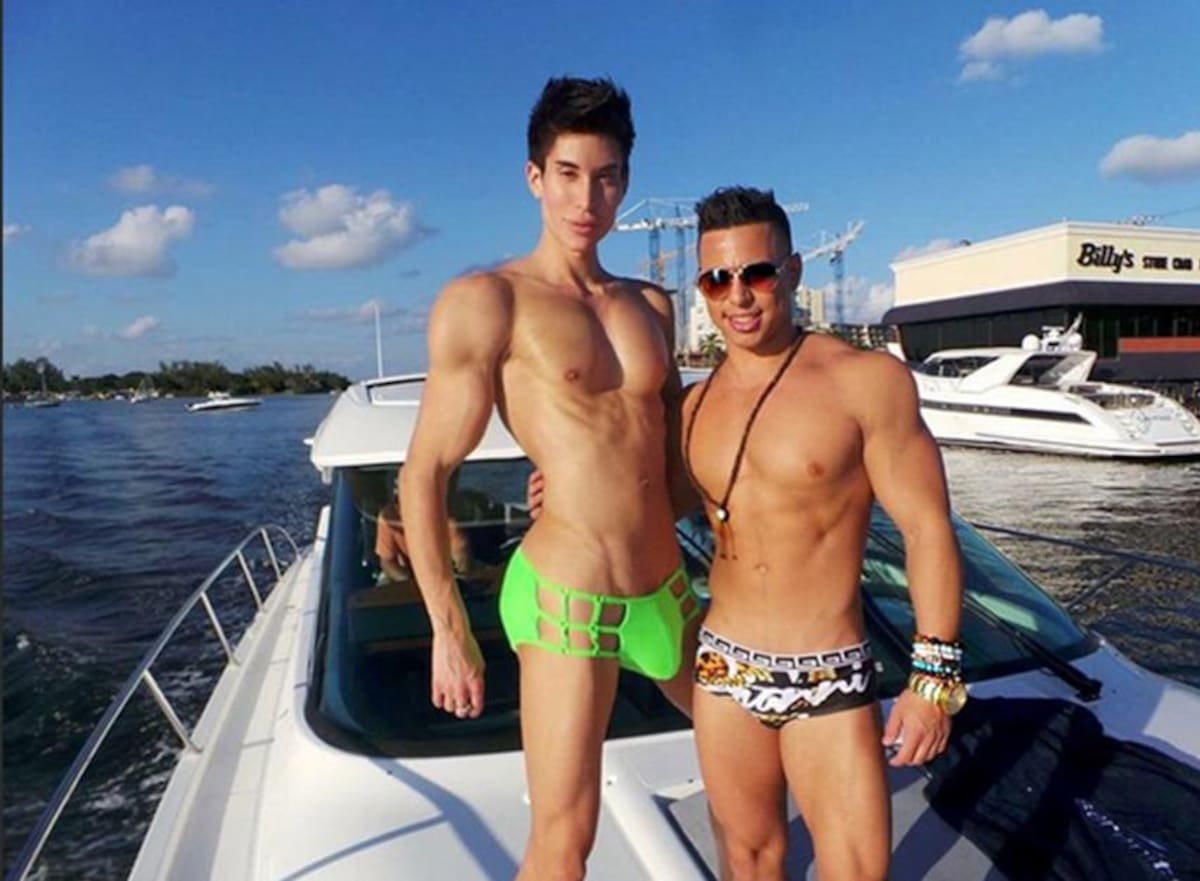 Justin Jedlica se operó para remover tres venas de su frente, intervención que lo pudo dejar ciego. Fotos: Instagram.