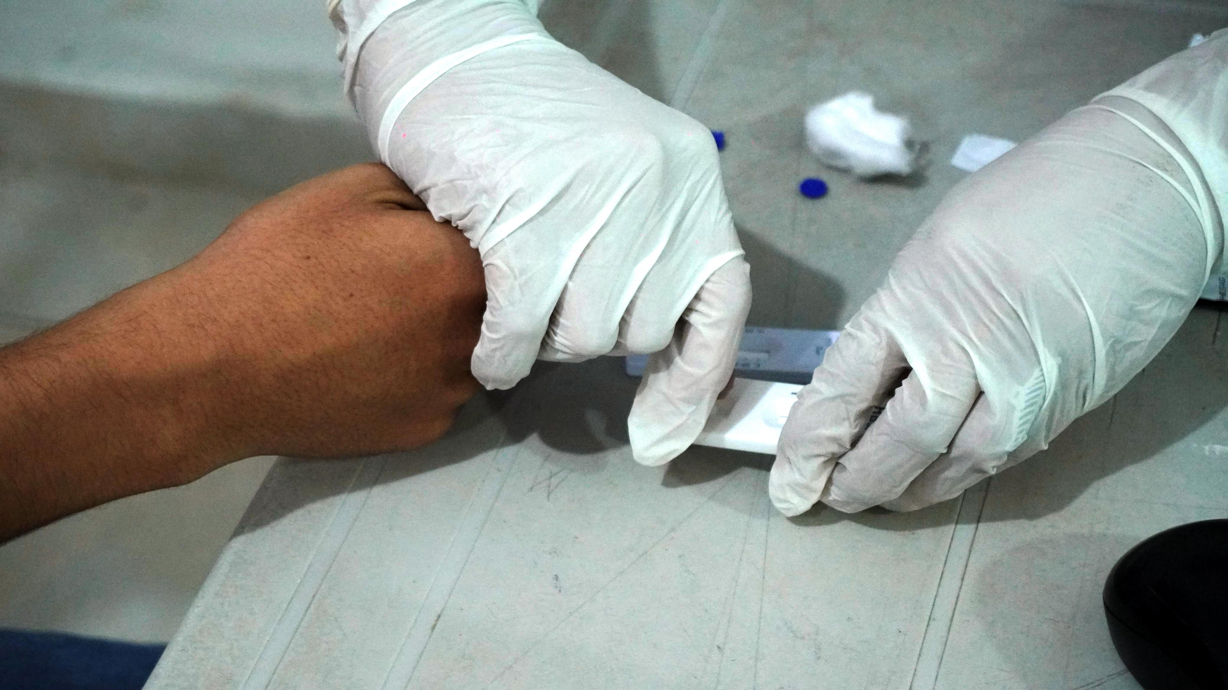 Cartagena reduce la tasa de notificación de casos de VIH en un 8 % en comparación con el 2024