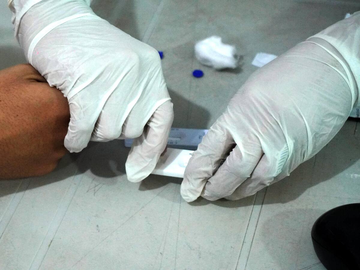 Cartagena reduce la tasa de notificación de casos de VIH en un 8 % en comparación con el 2024