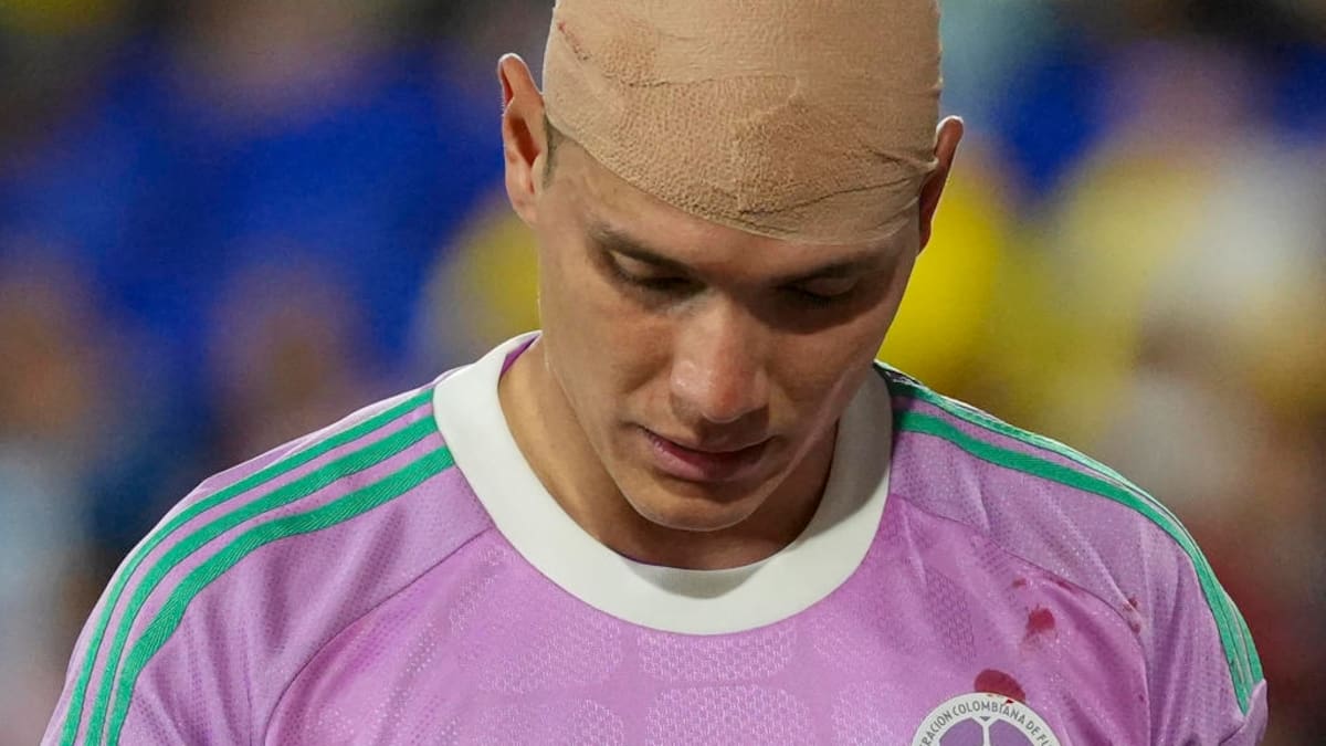 Aldair Quintana, luego del golpe en su debut con la Selección: “Estaba mareado y un poco confundido”