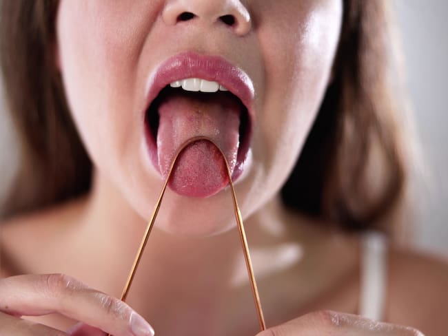 ¿Por qué la lengua se pone blanca? Causas y cómo evitarlo - Getty Images