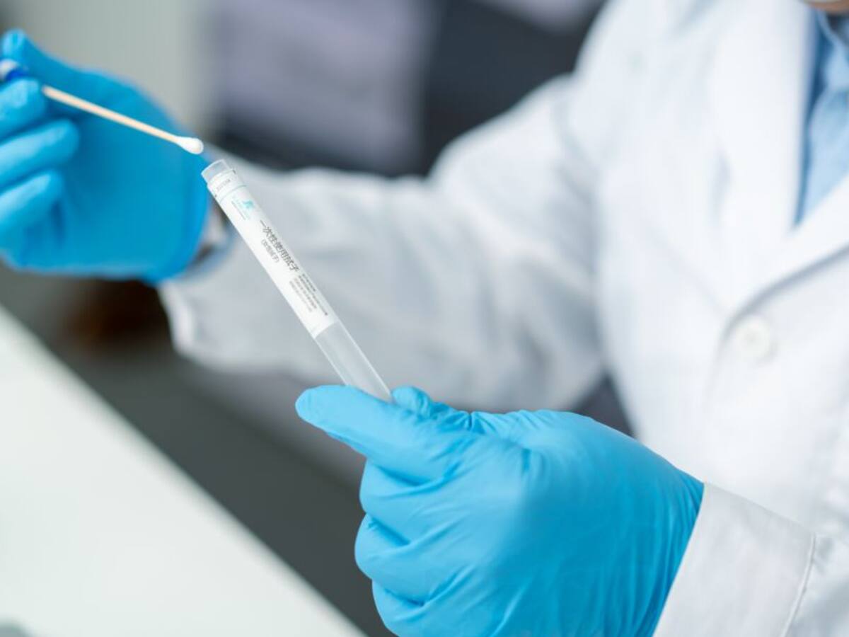 PCR vs prueba de antígenos: ventajas y desventajas para detectar la COVID