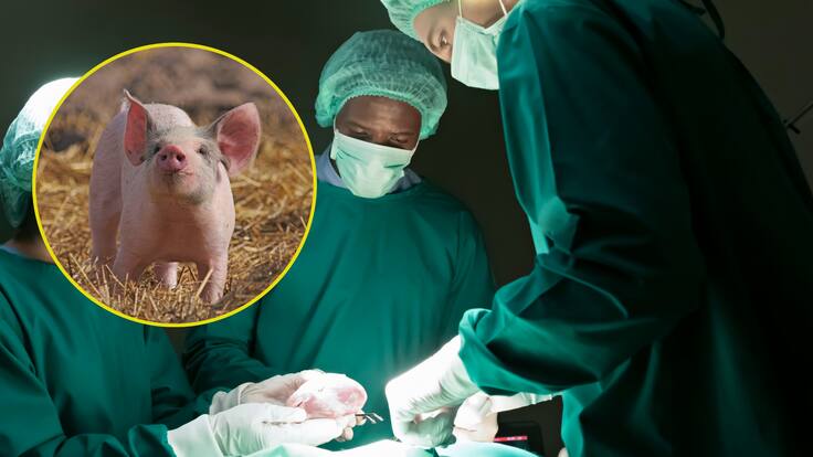 ¿Por qué se puede trasplantar el riñón de un cerdo en humanos? Nuevo caso de éxito