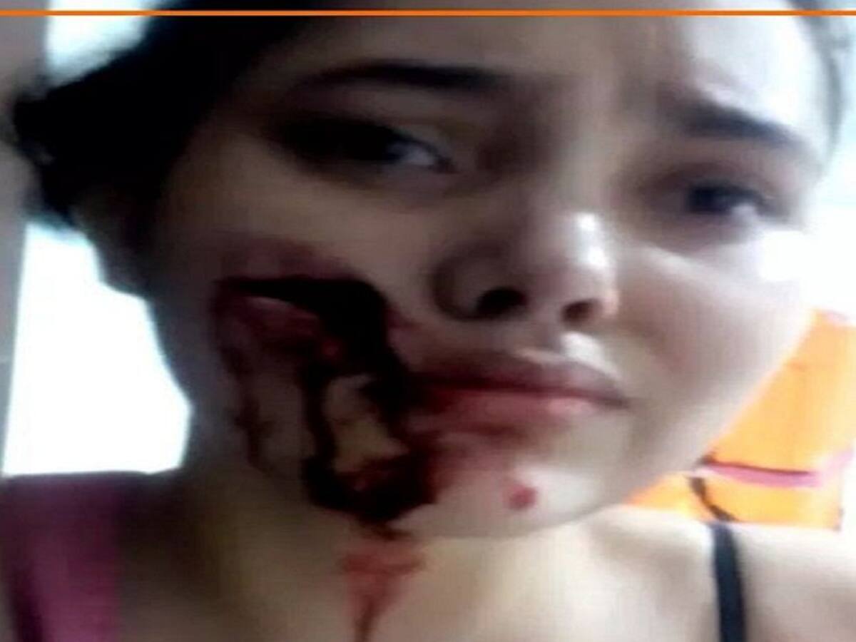 ¡Terrible! Un hombre le desfiguró el rostro a una joven en Planeta Rica
