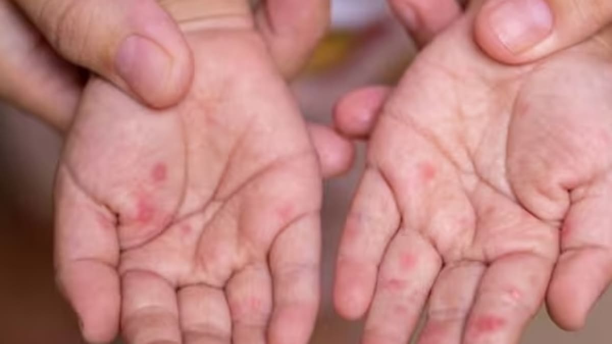 Secretario de Salud de Armenia, César Rincón