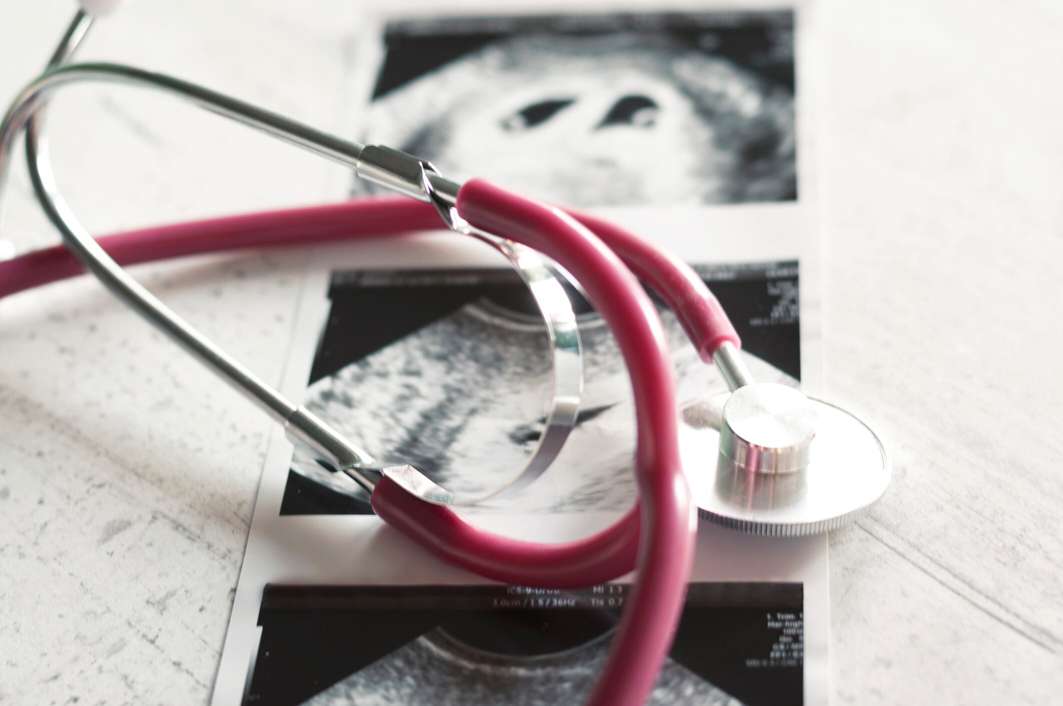 Desde el Senado se promoverá referendo para modificar fallo sobre interrupción voluntaria del embarazo