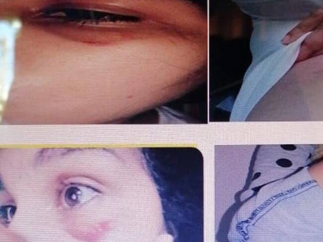 Abren investigación a policía que habría agredido a una mujer en Montería