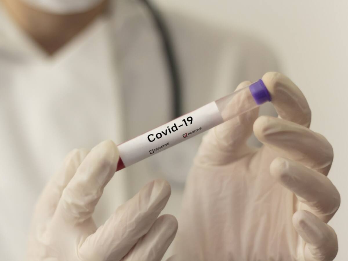 Confirman positivo para COVID-19 al coordinador de la línea 123 en Bogotá