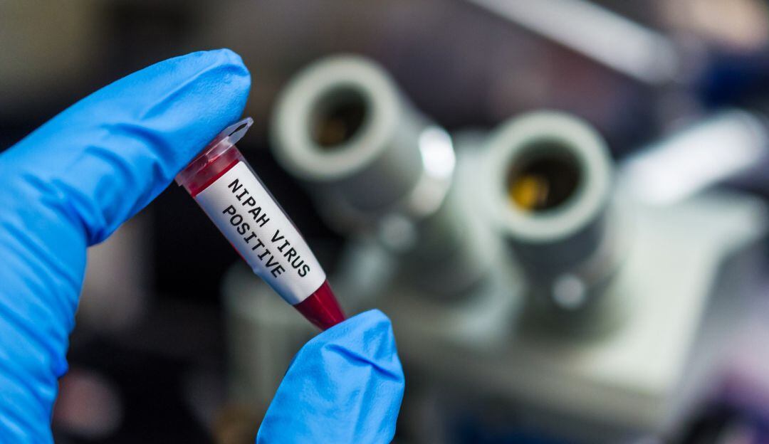 Henipavirus hoy: ¿Qué tan mortal es este nuevo virus de China?