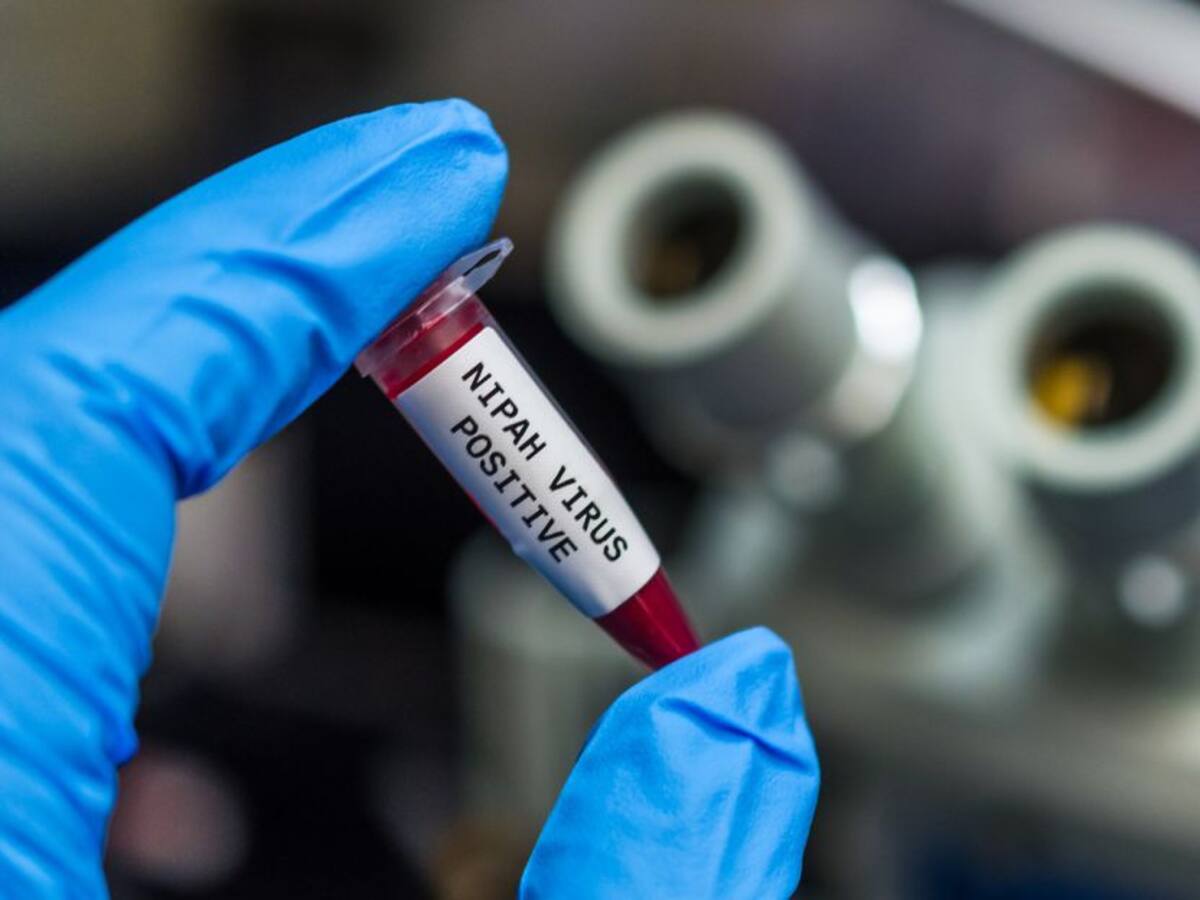 Henipavirus hoy: ¿Qué tan mortal es este nuevo virus de China?