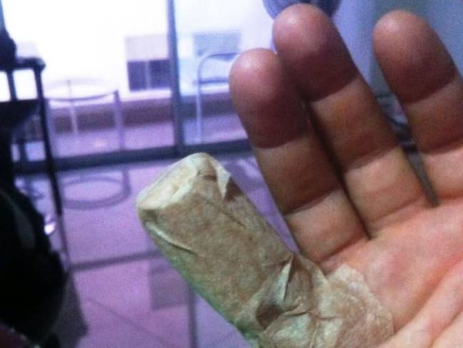 Caballo cochero arrancó parte de un dedo a un hombre en Cartagena