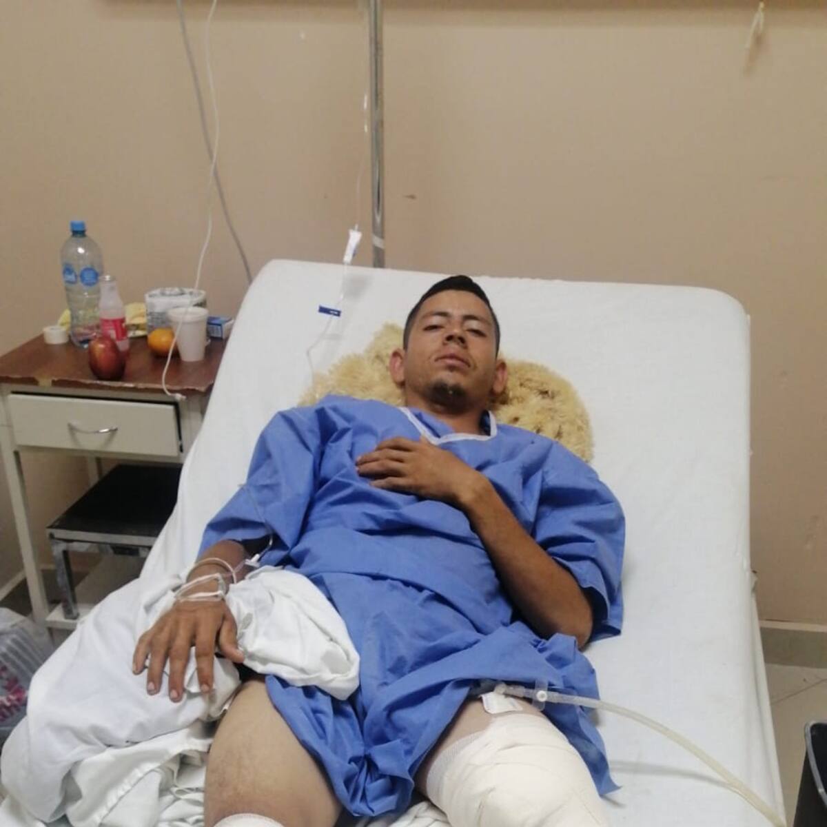Bumangués perdió pierna en busca del sueño americano