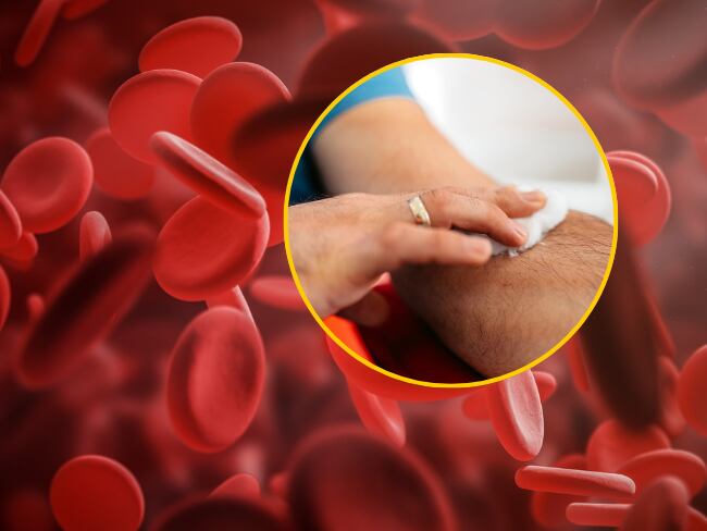 ¿Qué es la hemofilia? Enfermedad que padecía Kevin Acosta, menor que murió esperando medicamento. Getty Images