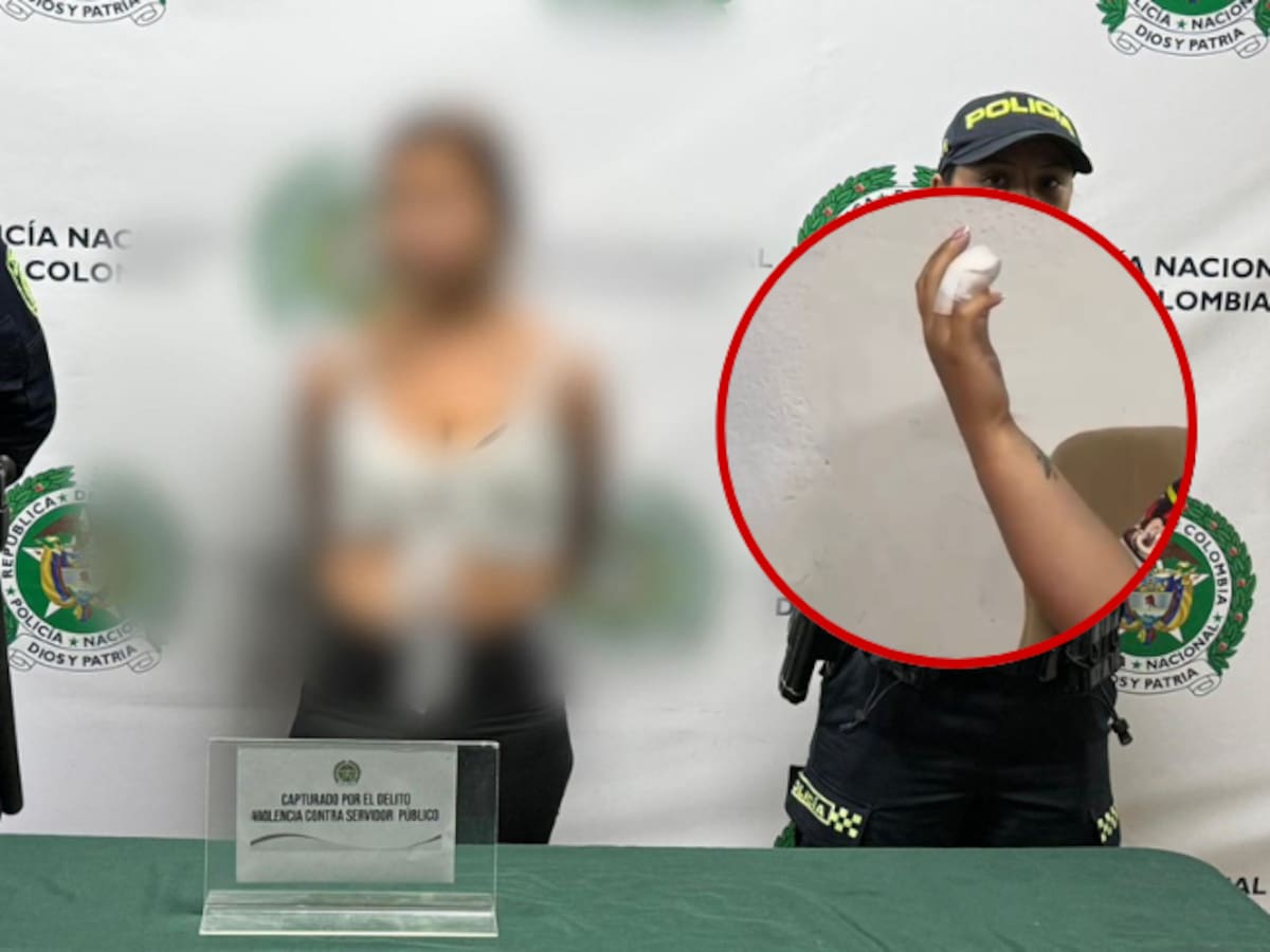 Mujer que mordió dedo de una patrullera de la Policía de Bogotá fue capturada