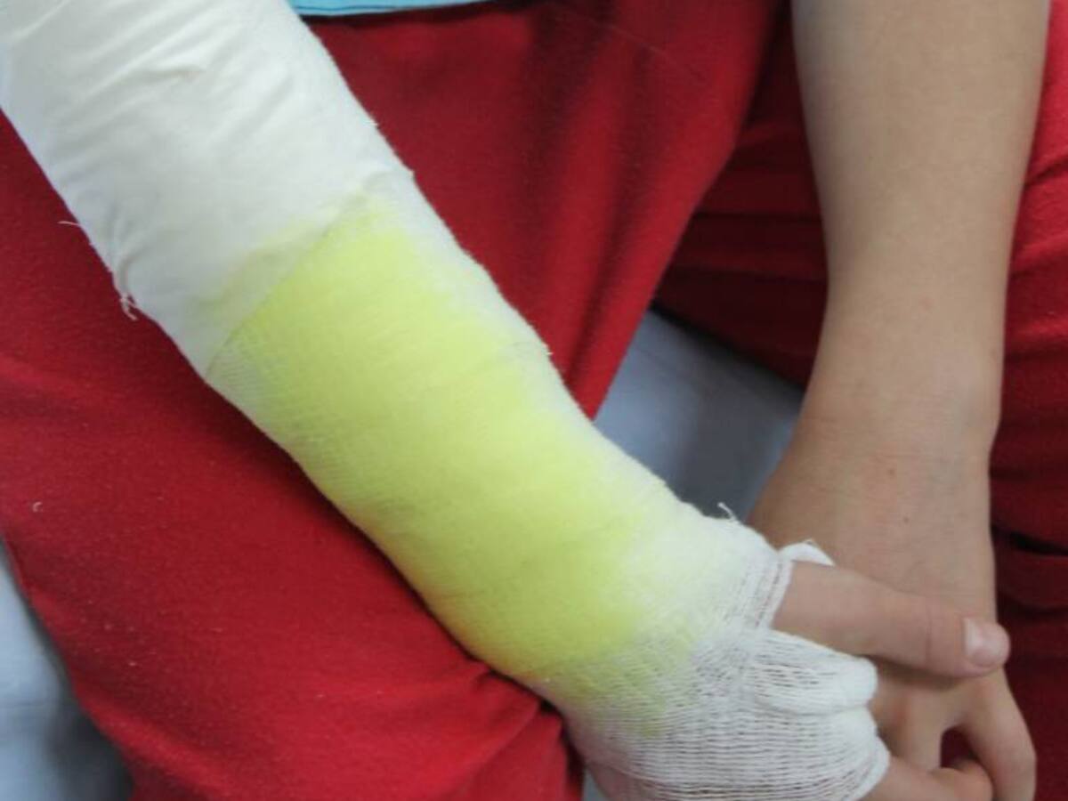 Sin comenzar la época decembrina, Antioquia reporta 50 heridos con pólvora