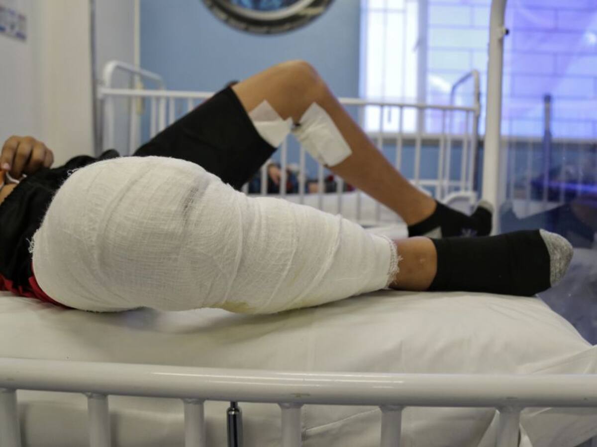 Aumentan casos de quemados con pólvora en Tolima