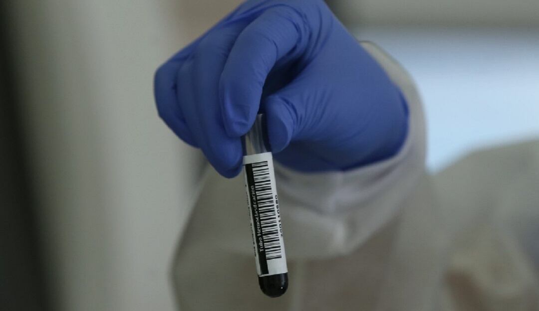 Variante de la cepa brasileña