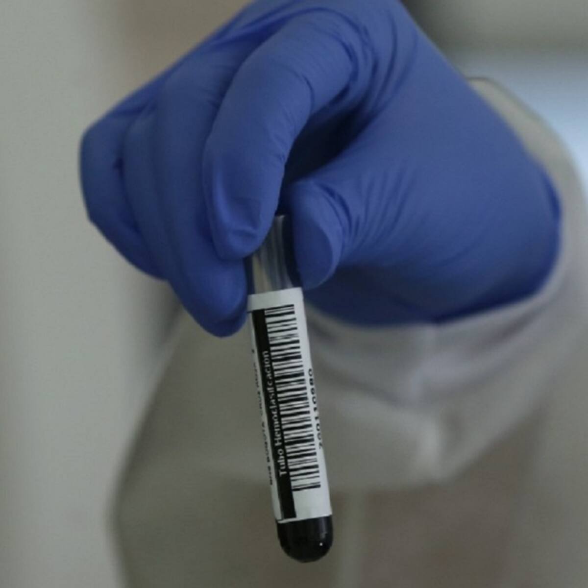 Aumentan pruebas de contagio buscando detectar cepa brasileña