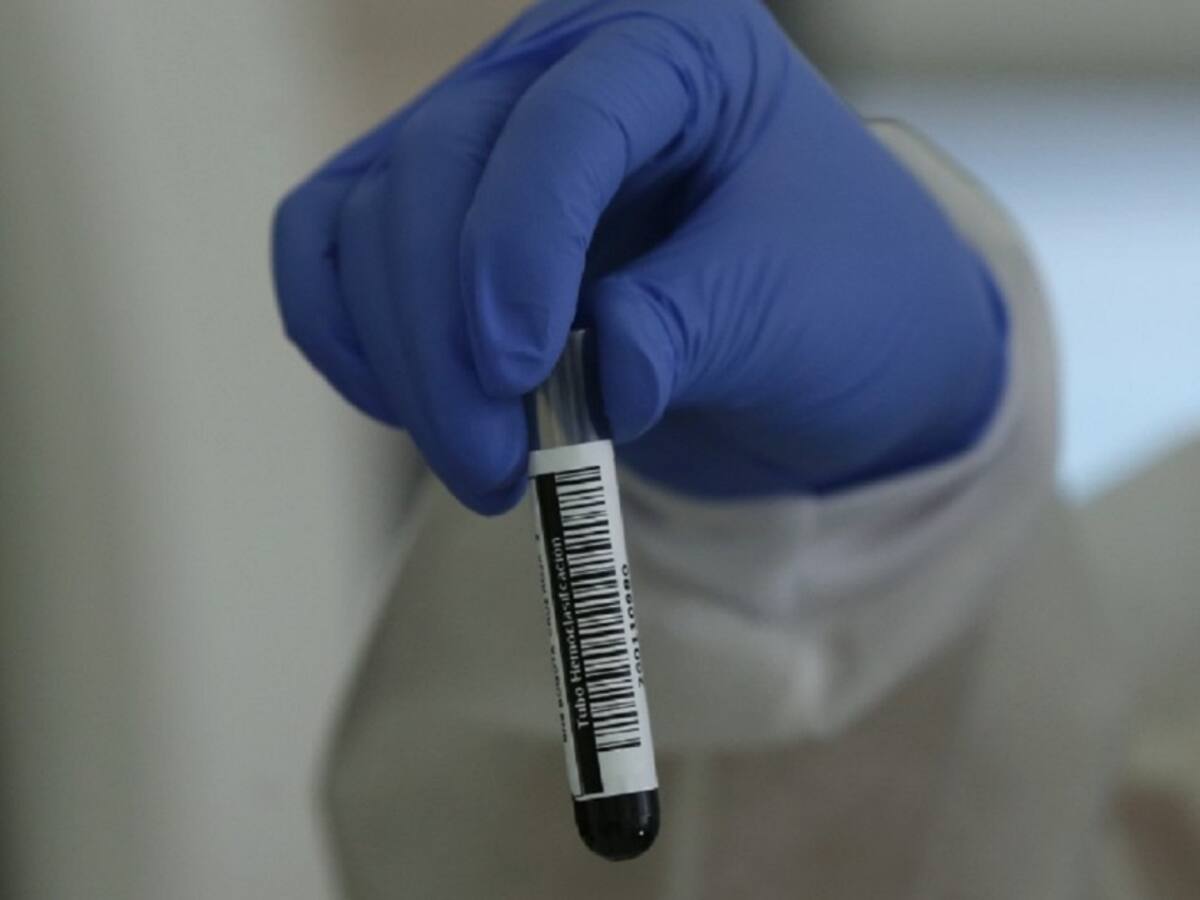 Aumentan pruebas de contagio buscando detectar cepa brasileña