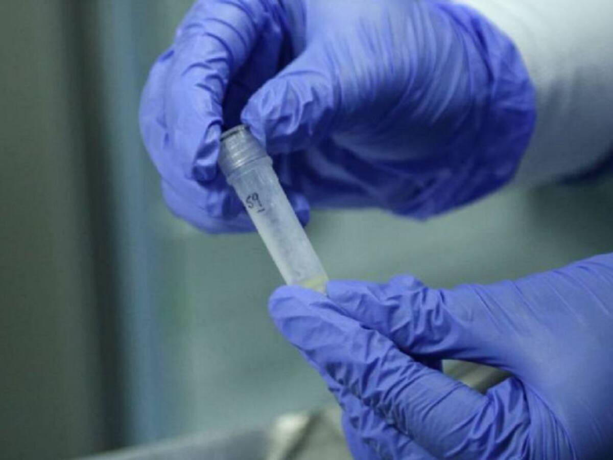 Coronavirus en Cartagena: 69 nuevos casos y no hubo fallecidos
