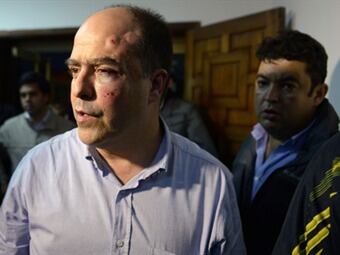 Julio Borges, diputado opositor herido en Asamblea Nacional venezolana. Foto: Eltiempo.com