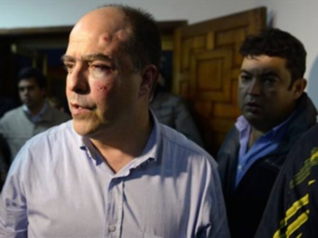 Julio Borges, diputado opositor herido en Asamblea Nacional venezolana. Foto: Eltiempo.com
