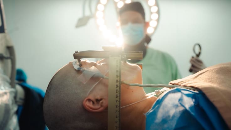 Dr. William Omar Contreras López, neurocirujano funcional del HIC