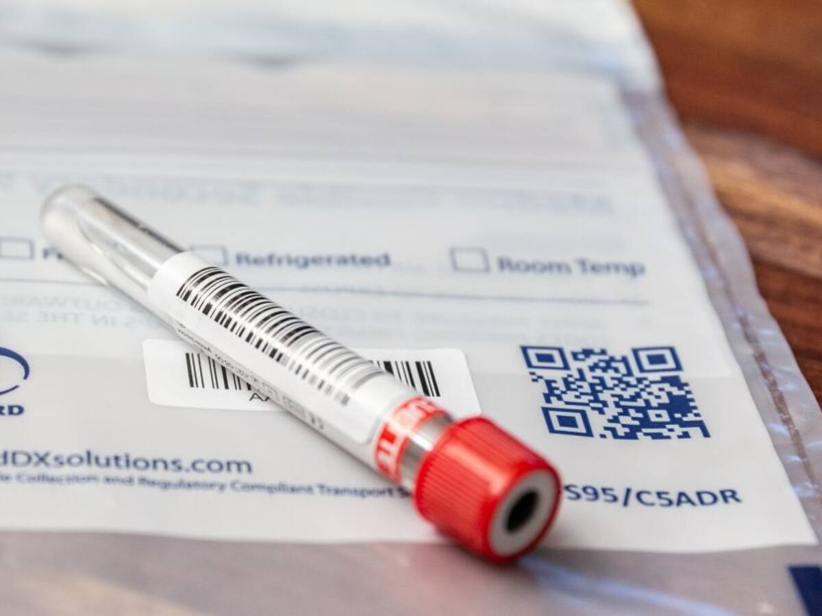 OMS reduce a la mitad el precio de pruebas de covid en países en desarrollo