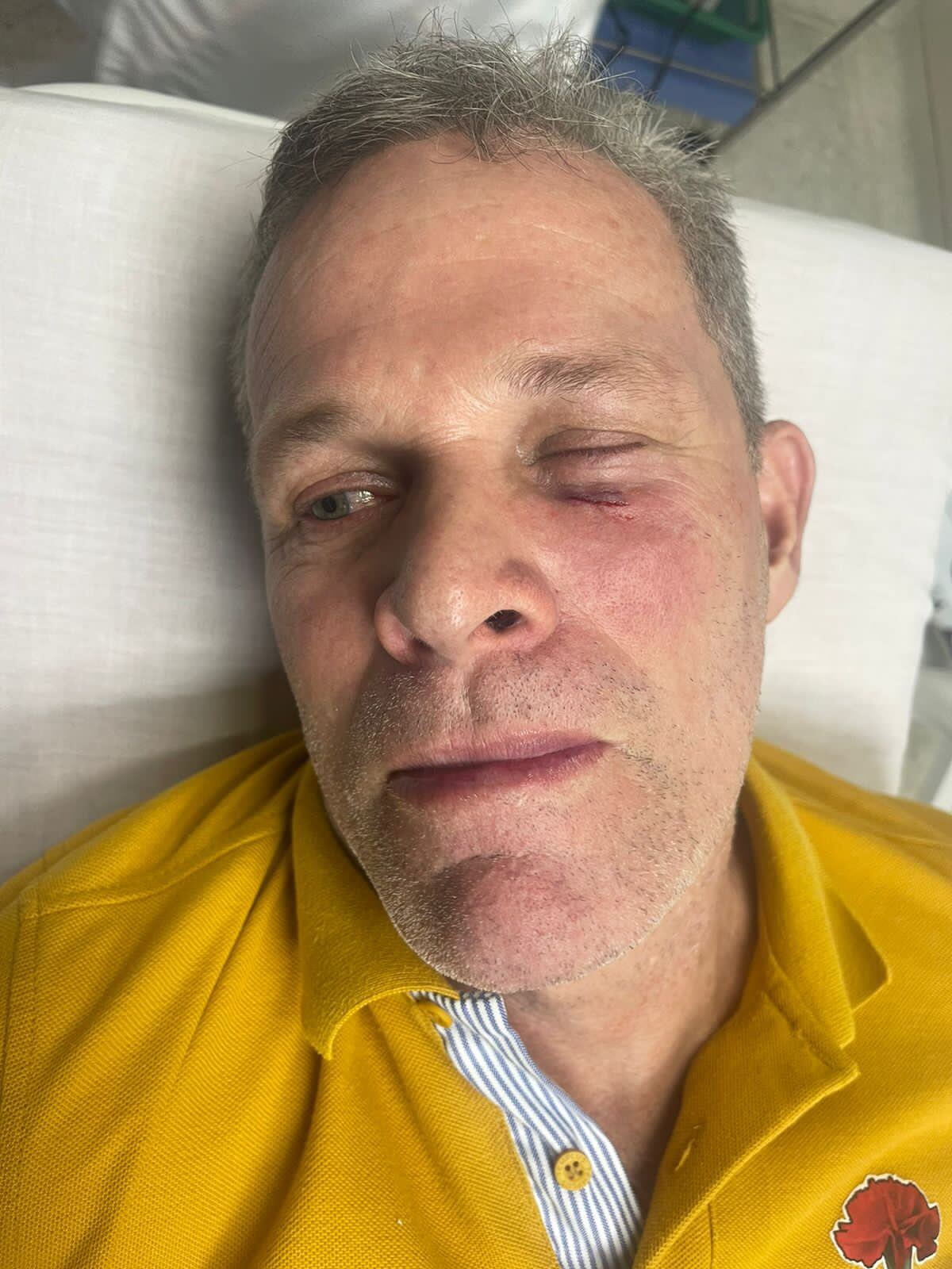 Candidato agredido en Ocaña/ Foto Cortesía