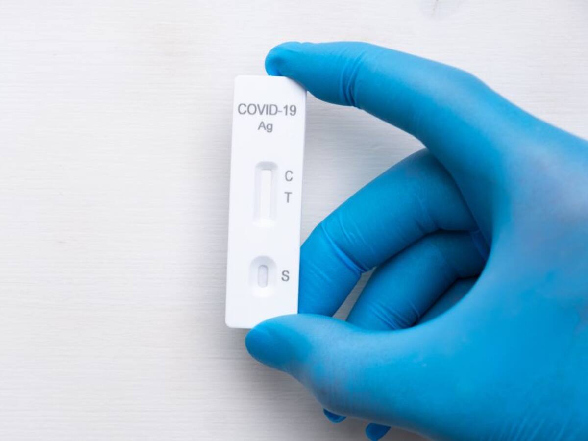 COVID-19 en Colombia: Leve disminución de casos nuevos para este lunes