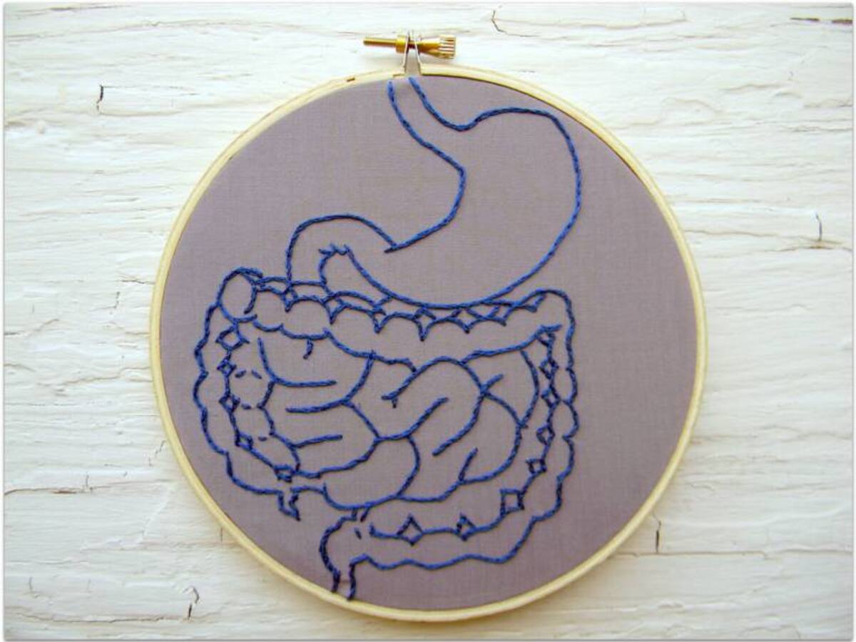 Intestino irritable - 3 de noviembre