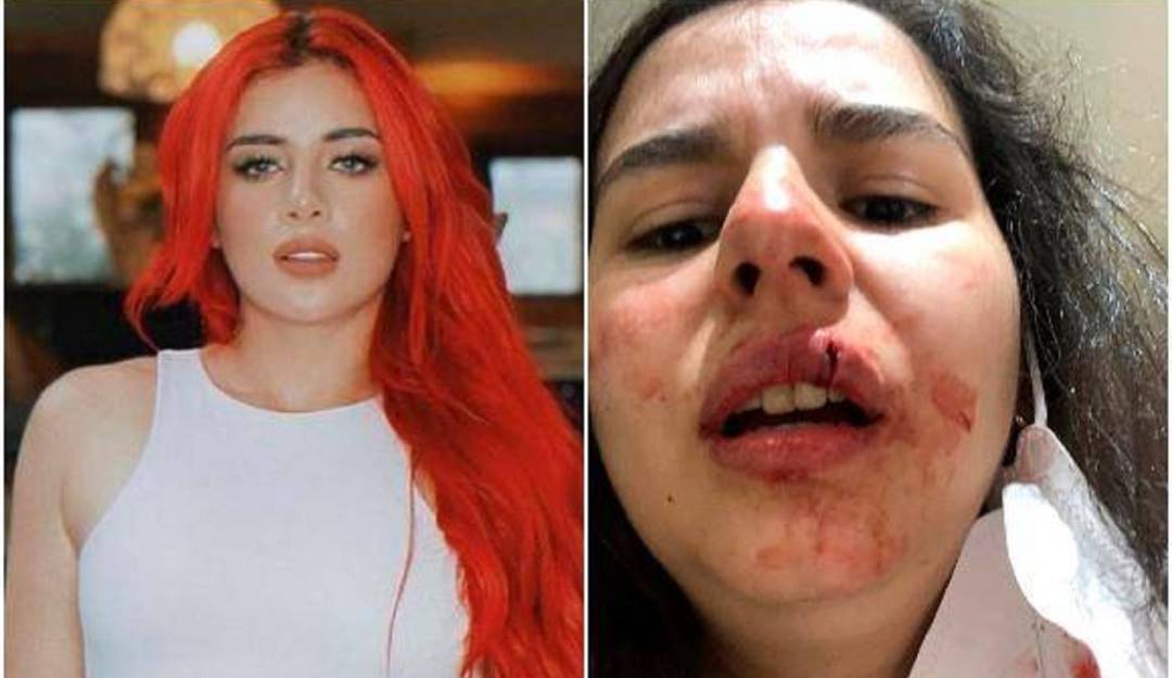 Vía Instagram y Twitter - Rafaella y Ana María Campos 