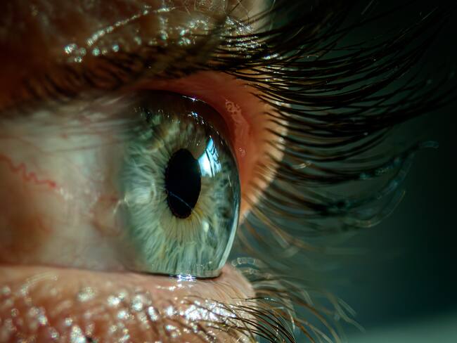 Ojo, imagen de referencia (Getty Images).