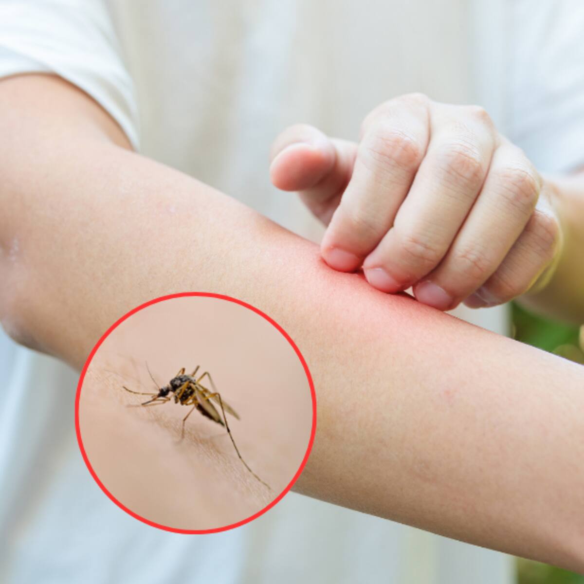 Temporada de mosquitos: métodos para evitar picaduras, según la ciencia