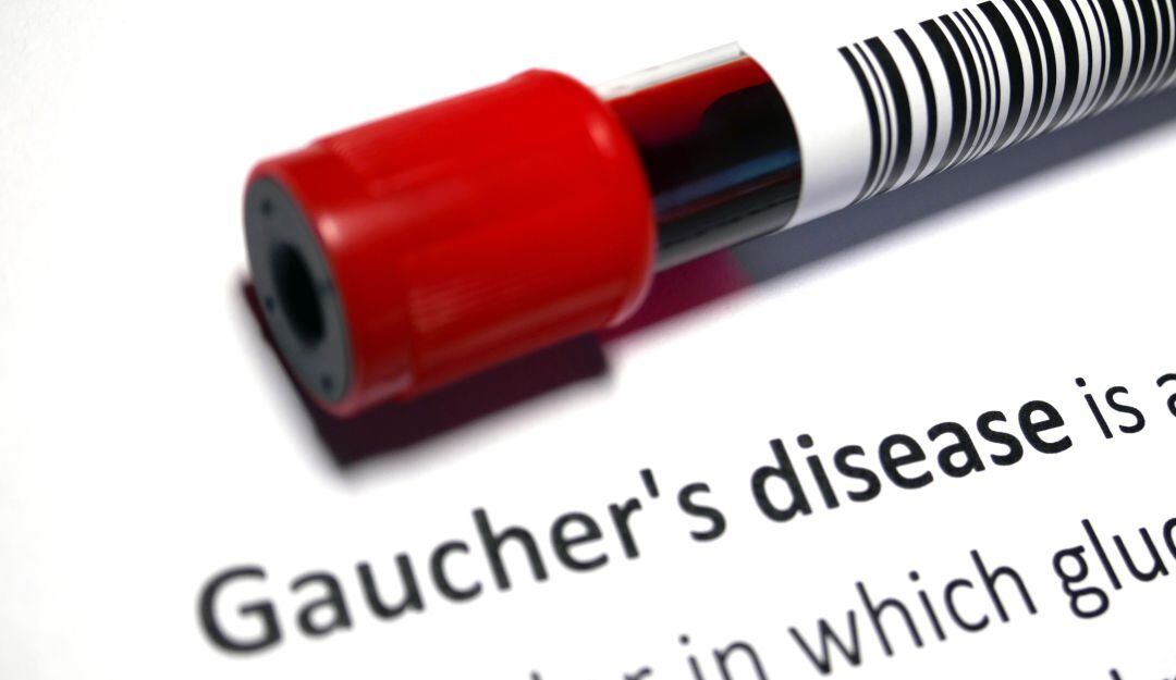 Gaucher: Una enfermedad huérfana que la padecen 260 personas en el país