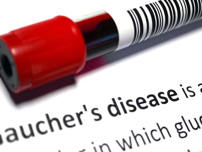 Gaucher: Una enfermedad huérfana que la padecen 260 personas en el país