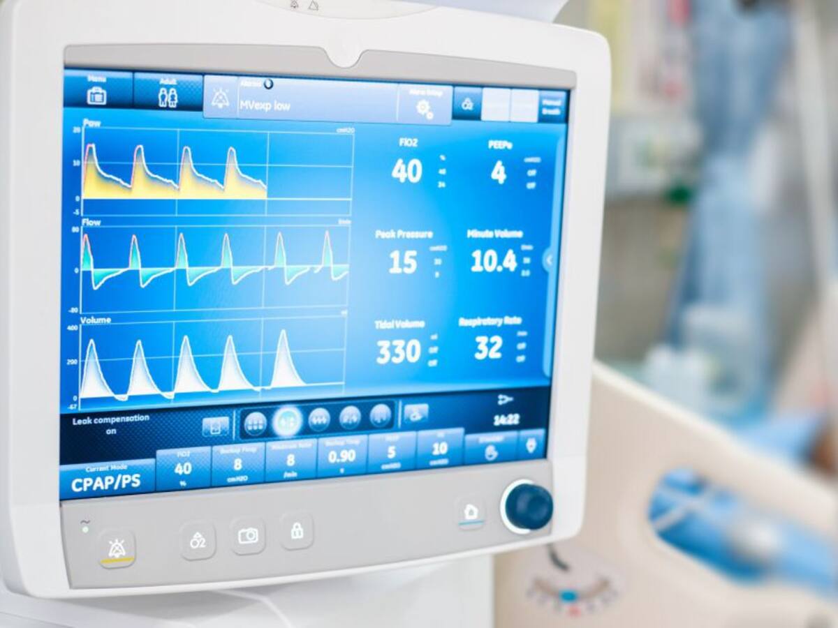 De los 1000 ventiladores que prometió el Gobierno solo llegarían 425