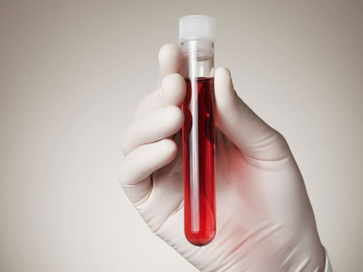 Ordenan atención médica a 51 reclusos de la Cárcel Modelo de Bogotá diagnosticados con SIDA