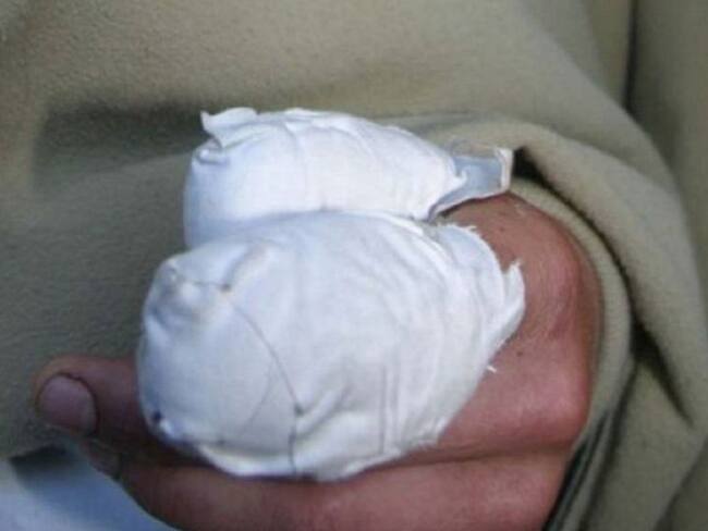 Secretaria de salud de Armenia, Lina Gil