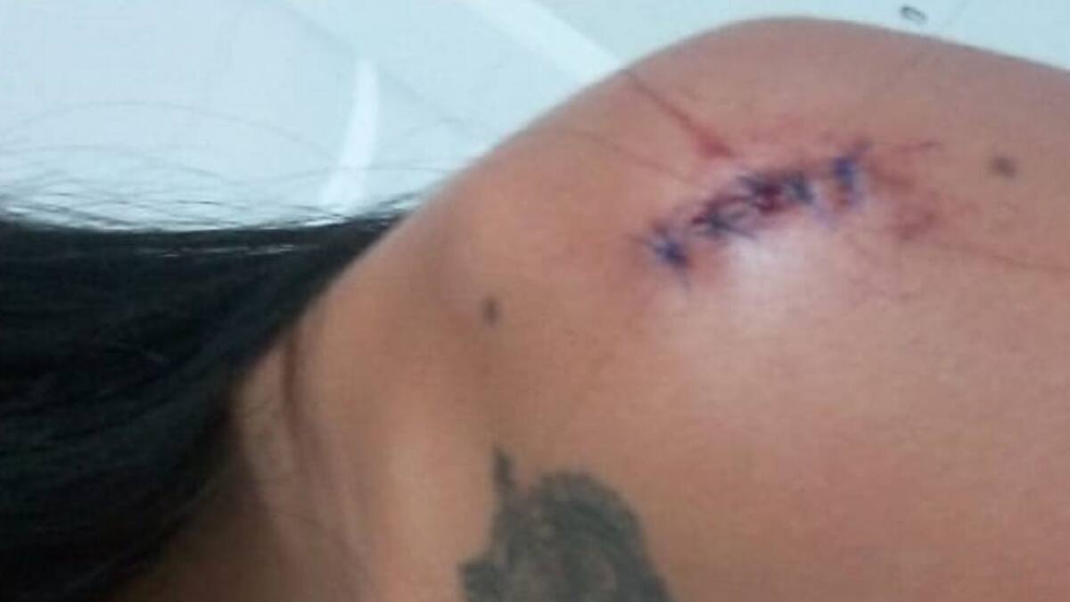 Denuncian ataque con arma blanca a mujer trans en Armenia