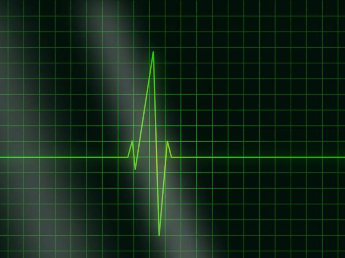 Enfermedad cardiovascular: Causas y tratamientos