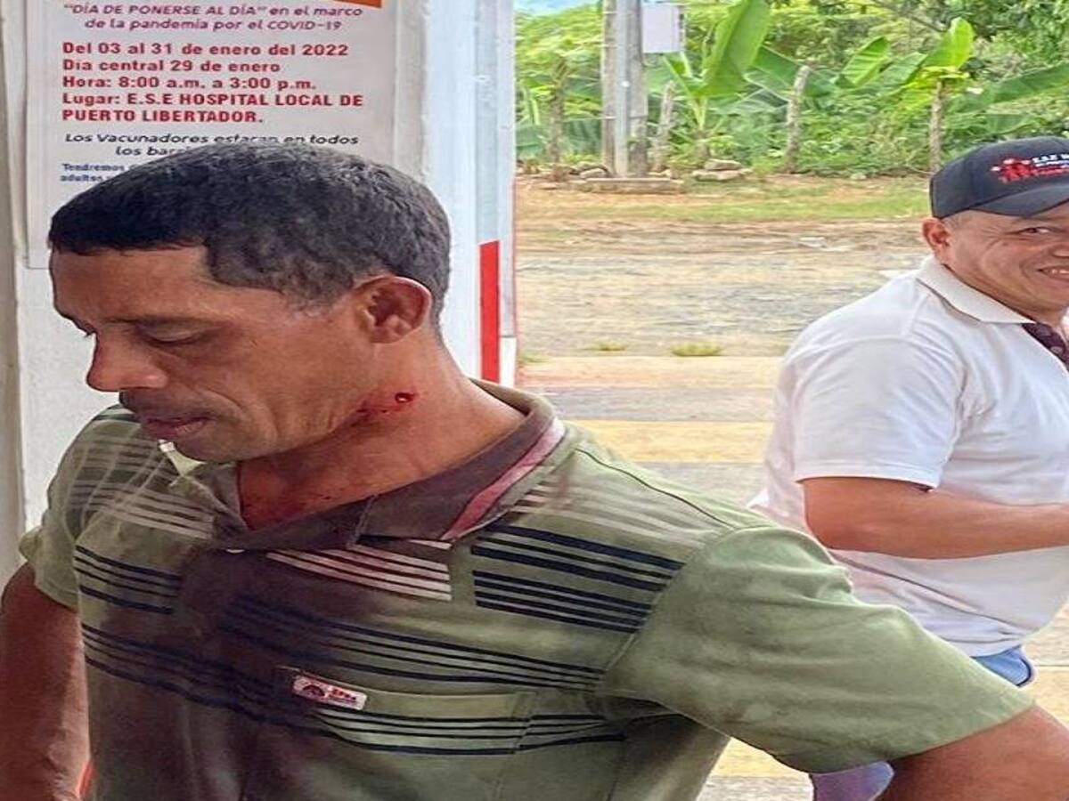 Campesinos resultaron heridos en enfrentamientos con la Policía en el sur de Córdoba