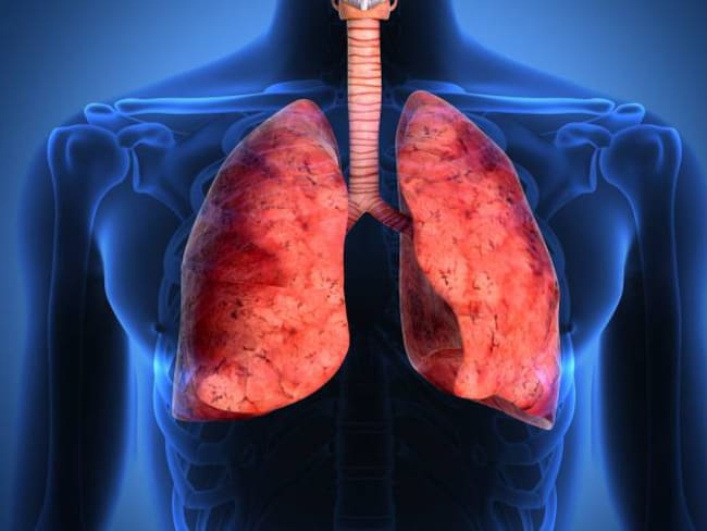 Cáncer de pulmón: su única causa no es el tabaquismo