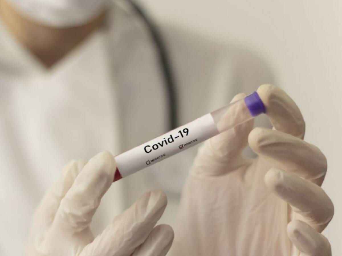 Se reportan 119 contagios de Coronavirus en Norte de Santander
