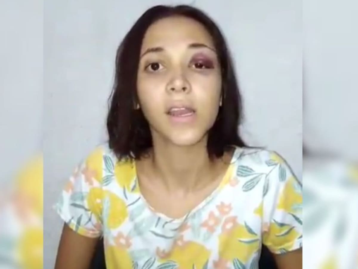 Arelys será trasladada a albergue tras agresión de su expareja