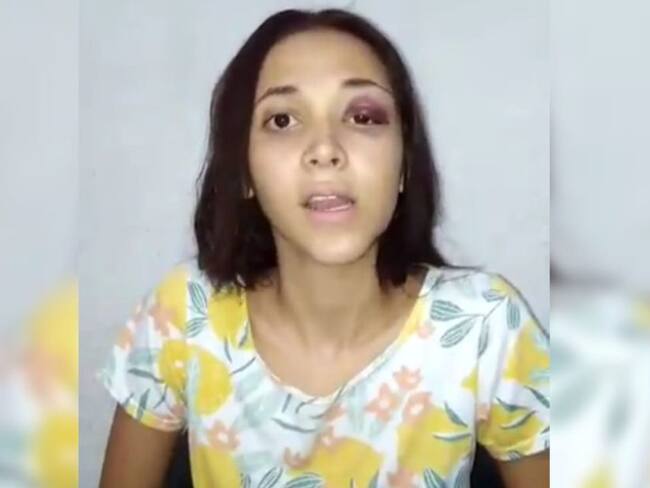 Arelys será trasladada a albergue tras agresión de su expareja