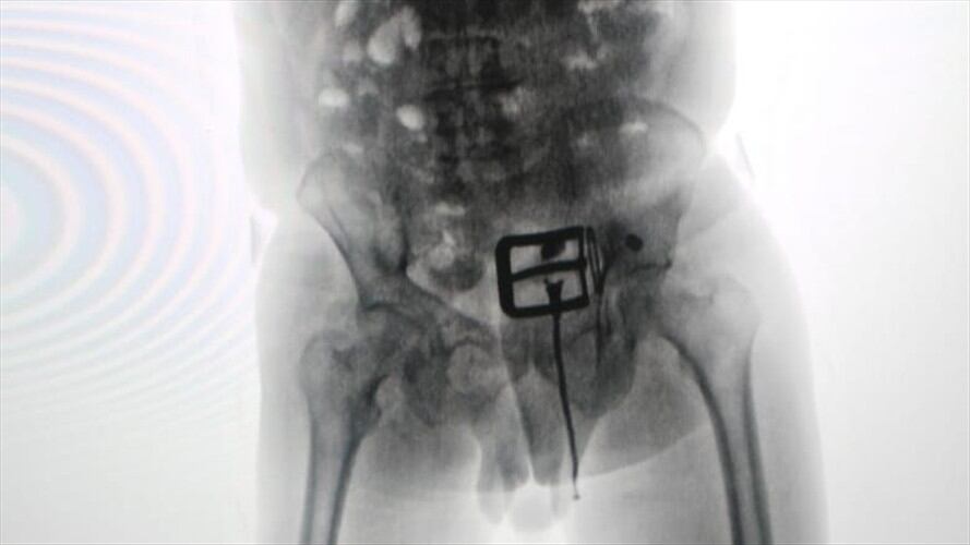 El hombre fue descubierto en el aeropuerto El Dorado de Bogotá. Foto: Policía Nacional.