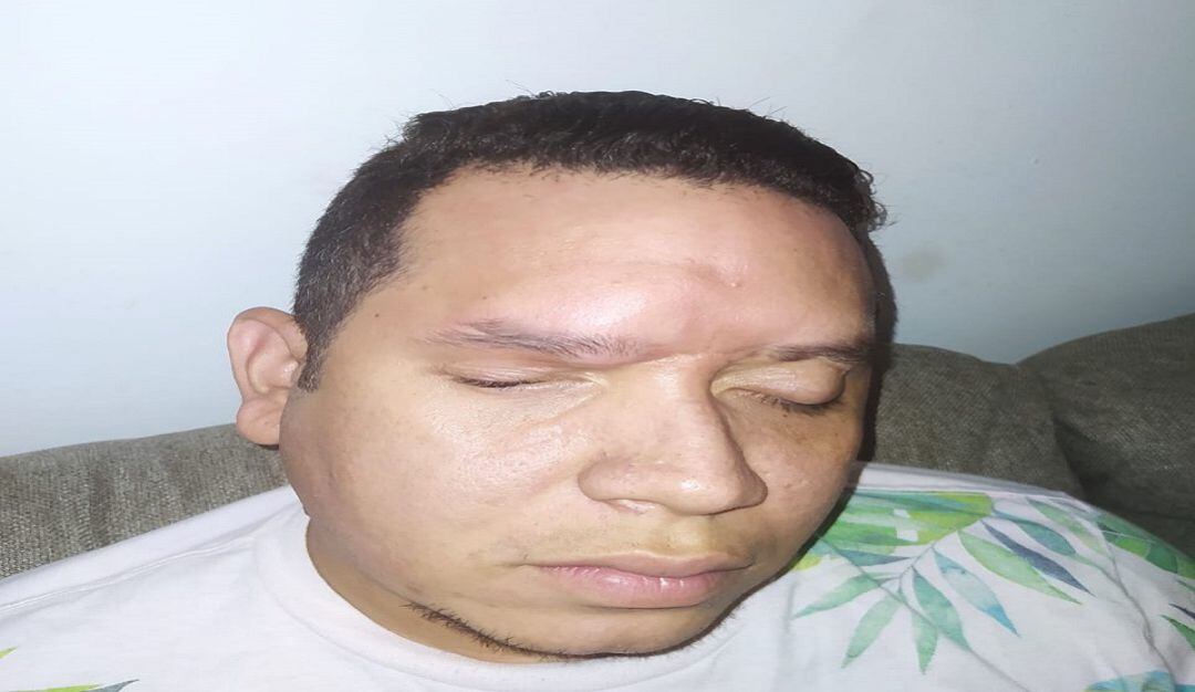 El paciente Yecith Castaño.