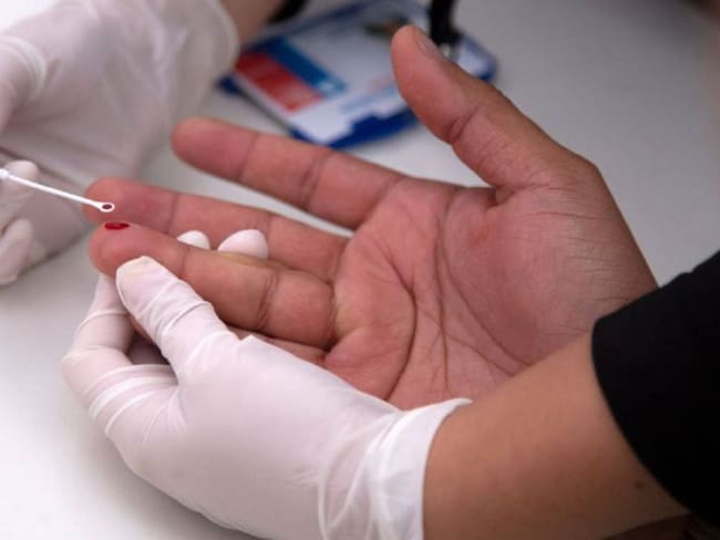 En Cartagena se han presentado 268 casos de VIH en lo que va del 2020