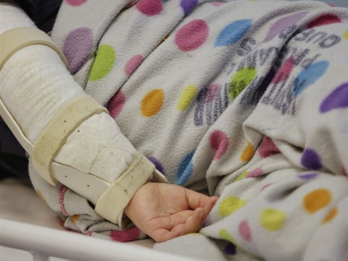 Menor mordido por una serpiente lleva casi un mes esperando un tratamiento adecuado